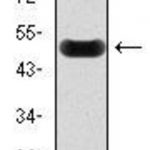 Anti-C-Reactive Protein (CRP) Antibody WB