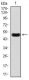 Anti-C-reaktives Protein (CRP) -Antikörper WB