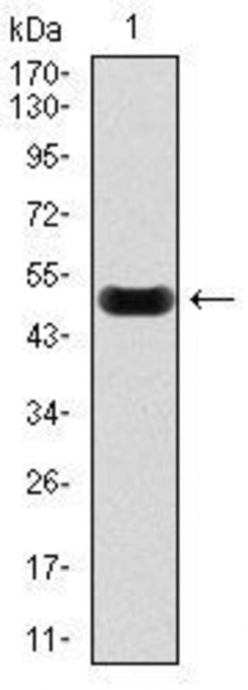 Anti-C-reaktives Protein (CRP) -Antikörper WB