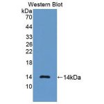 Anticorpo WB Anti-NT-ProBNP