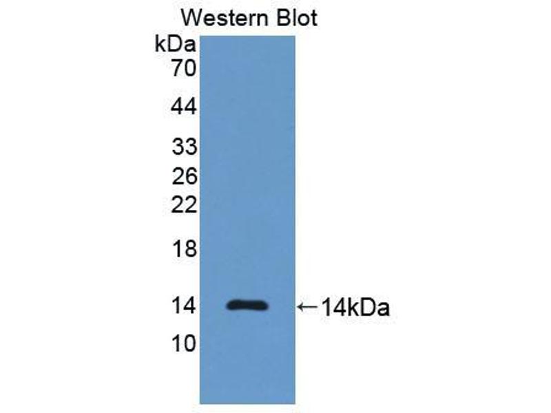 Anticorpo WB Anti-NT-ProBNP