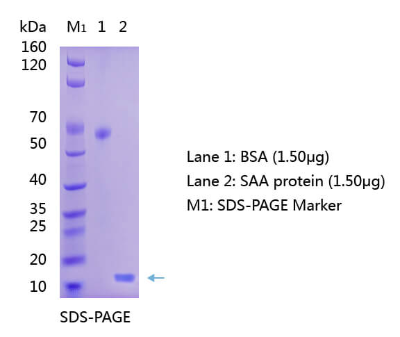 Anti-Serum-Amyloid A (SAA) -Antikörper WB