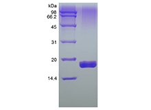 SDS-PAGE dari Rekombinan Manusia Tumor Larut Nekrosis Faktor-Terkait Apoptosis-inducing Ligand Receptor-2/TNFRSF10B