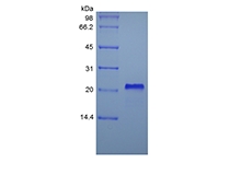 SDS-PAGE Reseptor Faktor Nekrosis Tumor Rekombinan Manusia Tipe I/TNFRSF1A