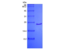 SDS-PAGE del factor de crecimiento de fibroblasto ácido humano recombinante, 2-155a.a.