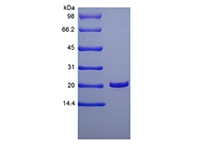SDS-PAGE rekombinowanego ludzkiego czynnika wzrostu keratynocytów 1/FGF-7