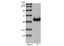 SDS-PAGE do Fator de Crescimento de Fibroblastos Humanos Recombinantes 17