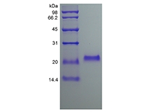 SDS-PAGE dell'osteoprotegerina umana ricombinante