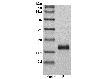 SDS-PAGE des rekombinanten murinen vaskulären endothelialen Wachstumsfaktors 120