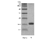 SDS-PAGE des rekombinanten Ratten-Granulozyten-Makrophagen-Kolonie-stimulierenden Faktors