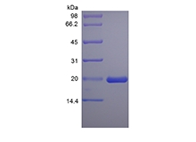 SDS-PAGE of Recombinant Rat Leukemia Inhibitory Factor