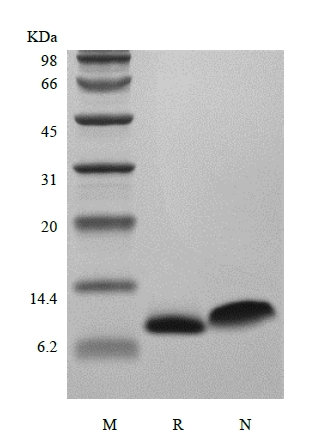 SDS-PAGE of Recombinant Human Regulation on Activation Normal T cell Express Sequence/CCL5