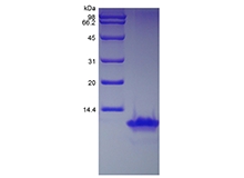 SDS-PAGE della proteina chemiotattica dei monociti umani ricombinanti-2/CCL8