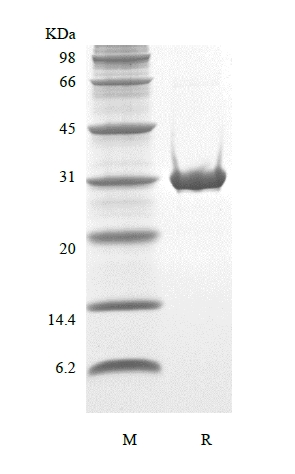 SDS-PAGE del regulador de glucólisis y apoptosis inducida por TP53 humano recombinante-TAT