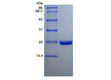 重组人泛素结合酶 E2 C、His 的 SDS-PAGE