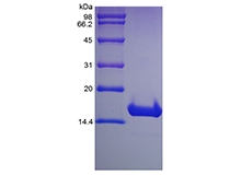 SDS-PAGE dari Rekombinan Manusia Cyclin-Dependent Kinase Inhibitor 2A, Isoform 1