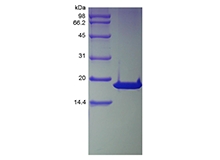 SDS-PAGE del inhibidor 2A de quinasa dependiente de ciclina humana recombinante, isoforma 1-TAT