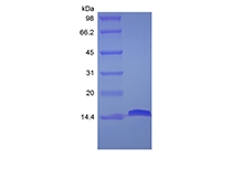 SDS-PAGE des rekombinanten menschlichen Fettsäuren-bindenden Proteins 2