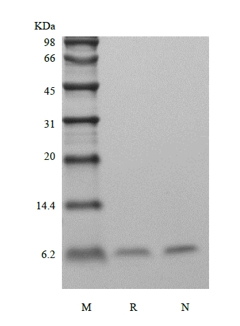 重組HBV表面抗原-preS2的SDS-PAGE