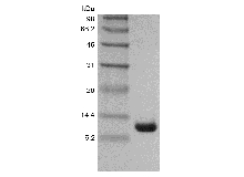 SDS-PAGE der rekombinanten Cholera-Toxin-B-Untereinheit