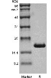 組換えヒトインターロイキン-1 α GMP の SDS-PAGE