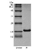 SDS-PAGE of Recombinant Human Interleukin-4 GMP
