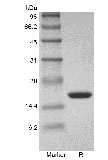 Recombinant Human Tumor Necrosis Factor-alpha/TNFSF2 GMP کا SDS-PAGE